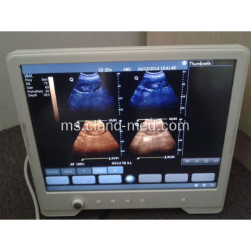 Harga Mesin Ultrasound Pengimbas Ultrasound Portable